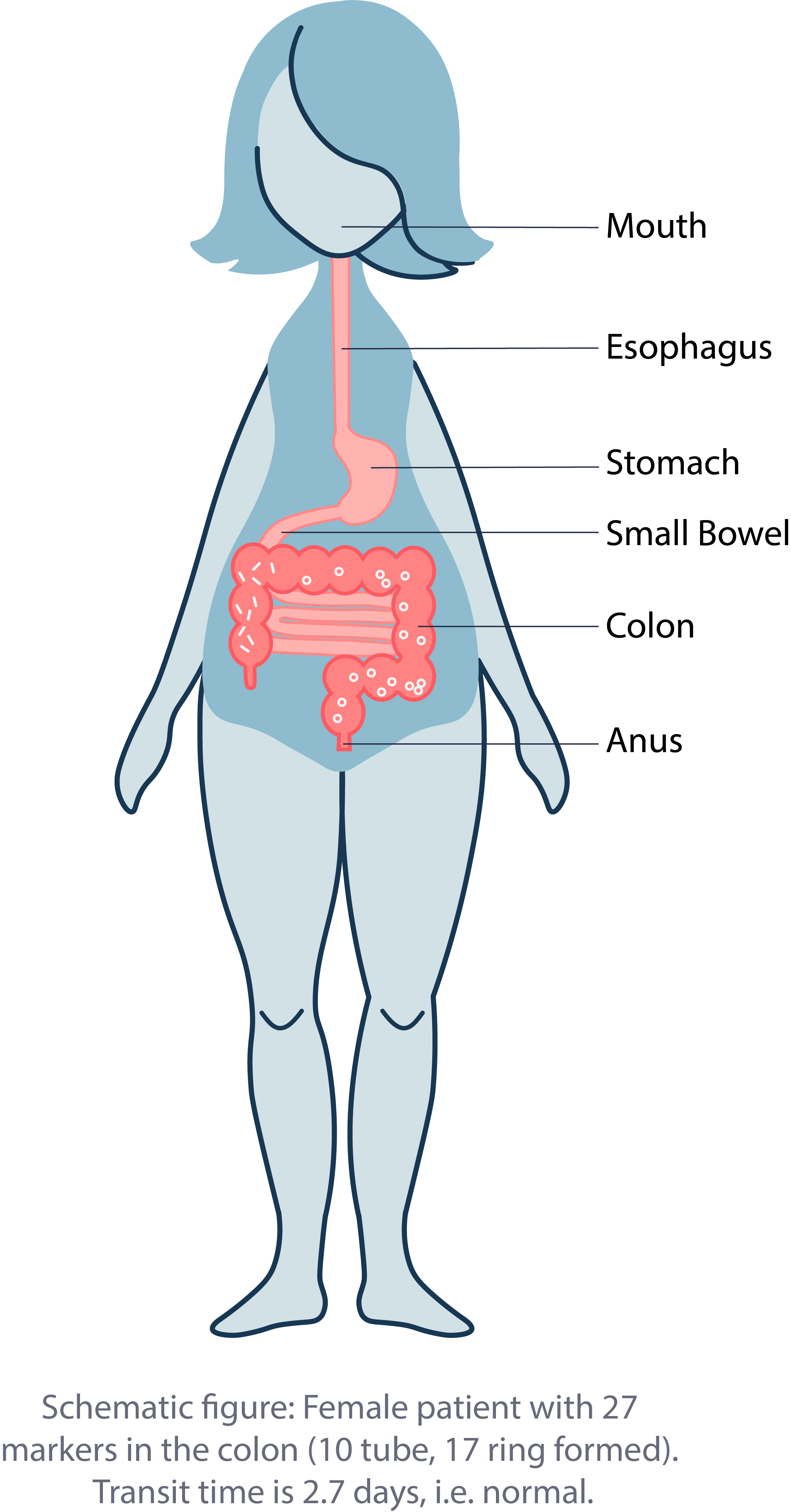 Schematic Figure Engelska Transparent Medifactia Ab